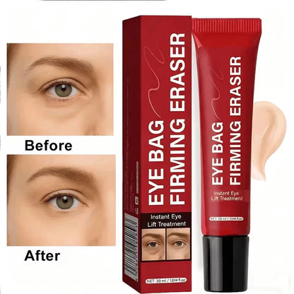 L'Oréal Revitalift Laser Instant Eye Bag Eraser Anti-Ageing Eye Cream 20g (0.71 oz)